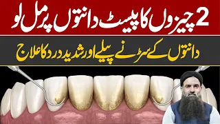 Teeth Whitening and Scaling | Teeth whitening | How To naturally Whiten Teeth | Dr Shrafat Ali