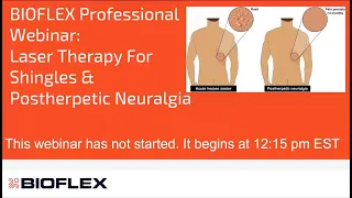 Laser Therapy For Shingles & Postherpetic Neuralgia