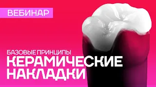 Керамические накладки - базовые принципы. Вебинар