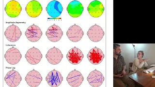 🧠🗺️ What is a Brain Map? QEEG Brainmapping, Neurostimulation and NeuroFeedback for Trauma, ASD 💡