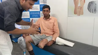 07835880155 -Part 1 - short below knee stump prosthesis- velocity foot from CPI - Agra UP