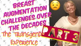 Trans Breast Surgery Decades Later Pt.3 | MTF SRS 57 year Transgender Transition