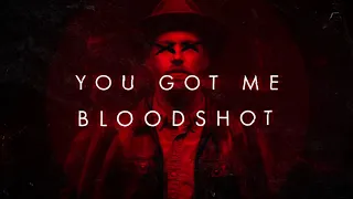 Sam Tinnesz - Bloodshot [Official Lyric Video]