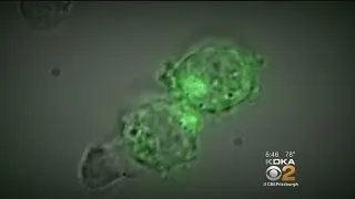 New Cancer Treatment Uses Patient's Immune System To Fight Disease