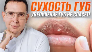 Как избавиться от СУХОСТИ ГУБ #сухостьгуб