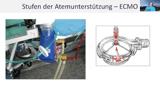 "Wenn nichts mehr geht – Wie Schwerstkranke  retten?"