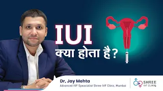 IUI क्या होता है? | IUI in Hindi | Intrauterine insemination | IUI Treatment Procedure |Dr Jay Mehta