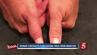 Tennessee woman almost loses her hand, says she contracted flesh-eating bacteria from nail salon