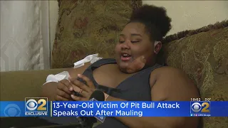 13-Year-Old Girl Speaks Out After Being Mauled By Pit Bulls