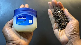 Mix cloves with Vaseline  ~ A secret nobody will never tell you. ~ thank me later