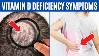 12 VITAMIN D DEFICIENCY SYMPTOMS You Need To Know!