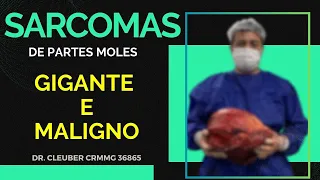 🦵Sarcomas: Diagnóstico, Tratamento e Cura 💪