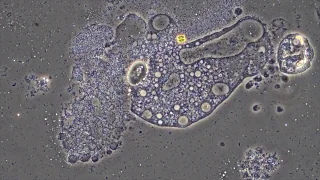 Germ vs Soap. What happens when we wash hands? (Microscope Footage)