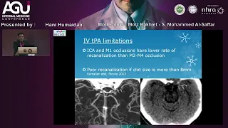 11  Hani Humaidan   Management of Acute Ischemic Stroke  Time is Brain