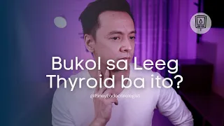 May Thyroid ba ako?