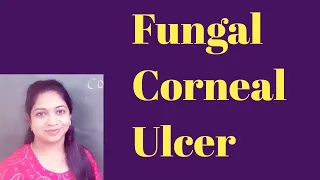 Fungal corneal ulcer|CORNEAL BIOPSY|Difference between fungal N bacterial corneal ulcer| Treatment