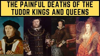 The PAINFUL Deaths Of The Tudor Kings and Queens - FULL Documentary