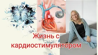 Жизнь с кардиостимулятором