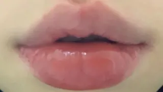 russian lip filler