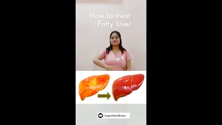 Cure fatty liver #shorts