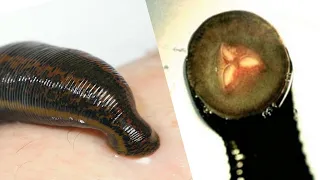 Leech: Why Is a Leech Bite Good for Us? | Leeches cure | Bloodsucker