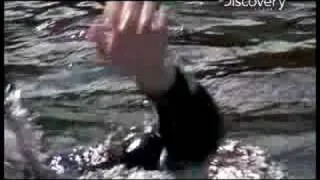 Man Loses Arm to Shark | Shark Bites