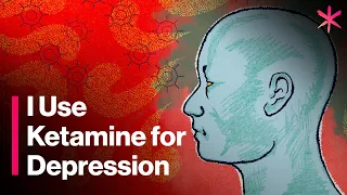 I Use Ketamine for Depression - Here’s How It Works