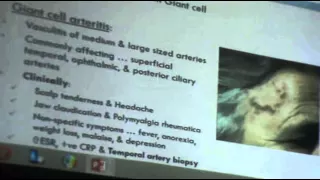 Ophthalmology - Dr.Mohammed Zayed - Neuro-ophthalmology - part 2