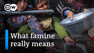Gaza famine could hurt people's health for decades | DW News