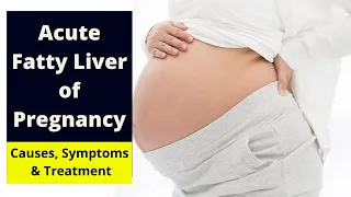 Acute Fatty Liver of Pregnancy: Symptoms and Treatments Uncovered