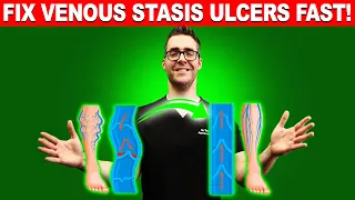 STOP Varicose Veins & Venous Stasis Ulcers FAST!