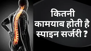 Success Rate of Spine Surgery |  कितनी कामयाब होती है स्पाइन सर्जरी? | Dr Sahil Batra
