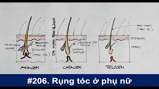 #206. Rụng tóc ở phụ nữ và cách chữa trị?