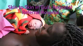 Skin to Skin (9 Stages) in Gulu, Uganda – English