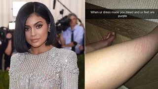 Kylie Jenner's Met Gala Outfit Made Her Bleed?!