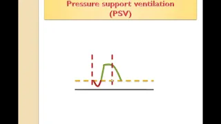 10 - Tenth lecture: CPAP, PSV, PSV pro