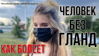 ТОНЗИЛЛЭКТОМИЯ КАК Я БОЛЕЮ БЕЗ ГЛАНД?