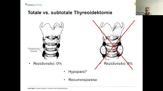 How I do it - Morbus Basedow: Operation oder Radiotherapie - Viszerale Chirurgie