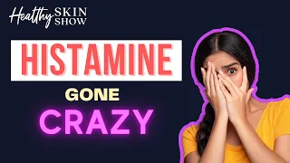 MCAS Mast Cell Activation Syndrome Symptoms + Treatment (It's Histamine Hell) | Jill Carnahan