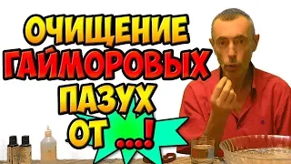 ОЧИЩЕНИЕ ГАЙМОРОВЫХ ПАЗУХ ОТ ...! Виталий Островский. Грипп, простуда, гайморит, гипотиреоз.