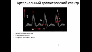 Допплеровская спектральная кривая.Что есть норма?