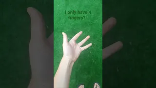I only have 4 fingers?!✋🏻 #hand #finger #shorts