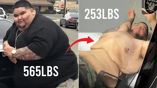 My 300lbs Weight Loss Left Me With 20lbs Of Loose Skin | BRAND NEW ME