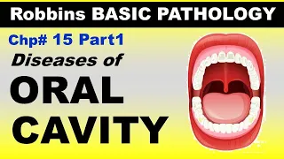 Robbins Basic Patho Chp15 (Part1) | Diseases of Oral Cavity | Dr Asif Lectures