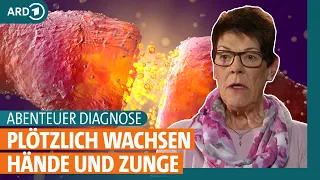 Abenteuer Diagnose: Woher kommen Sprachstörungen und plötzlich wachsende Hände? | ARD Gesund