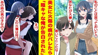 【漫画】6年前に少女を助けて首に火傷の痕が残った俺。クールで有名な学校一の美少女に「この首の火傷って…！？」とバレたら、なぜか俺の世話を焼くようになった。まさか彼女の正体は…！？【恋愛漫画】