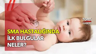 SMA Hastalığı Nedir? - Dün Bugün Yarın