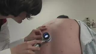 Melanoma Monday: New hope for those with an advanced form of the disease