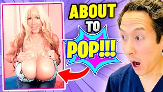 Plastic Surgeon Reacts to LARGEST BREASTS Ever!! EXTREME Bodies EXPLAINED!