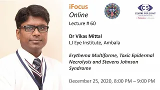 iFocus Online Session 60, Erythema Multiforme, TEN and Stevens Johnson Syndrome by Dr Vikas Mittal